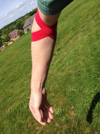 my-arm-bandage-after-platelet-donation-e1401936885425